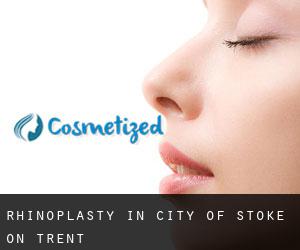 Rhinoplasty in City of Stoke-on-Trent