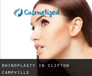 Rhinoplasty in Clifton Campville