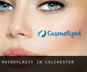 Rhinoplasty in Colchester