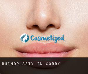 Rhinoplasty in Corby