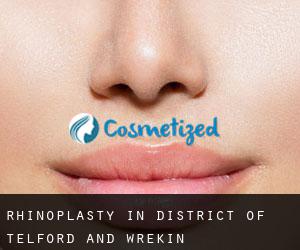 Rhinoplasty in District of Telford and Wrekin Rhinoplasty in District of Telford and Wrekin
