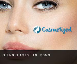 Rhinoplasty in Down