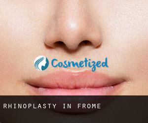 Rhinoplasty in Frome