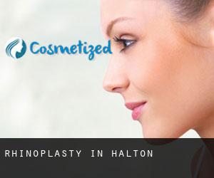 Rhinoplasty in Halton