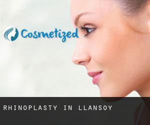 Rhinoplasty in Llansoy