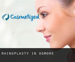 Rhinoplasty in Ogmore