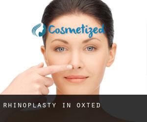 Rhinoplasty in Oxted