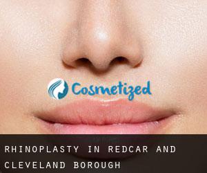 Rhinoplasty in Redcar and Cleveland (Borough)