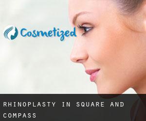 Rhinoplasty in Square and Compass
