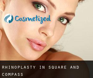 Rhinoplasty in Square and Compass