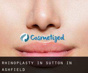 Rhinoplasty in Sutton in Ashfield Rhinoplasty in Sutton in Ashfield