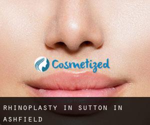 Rhinoplasty in Sutton in Ashfield