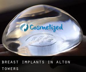 Breast Implants in Alton Towers