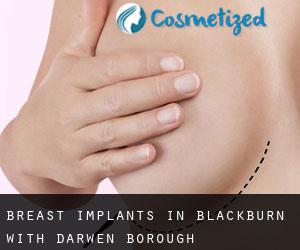 Breast Implants in Blackburn with Darwen (Borough)