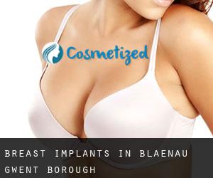 Breast Implants in Blaenau Gwent (Borough)