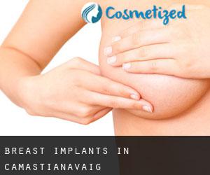 Breast Implants in Camastianavaig