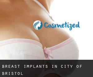 Breast Implants in City of Bristol Breast Implants in City of Bristol
