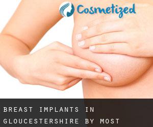 Breast Implants in Gloucestershire by most populated area - page 3
