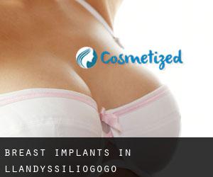 Breast Implants in Llandyssiliogogo