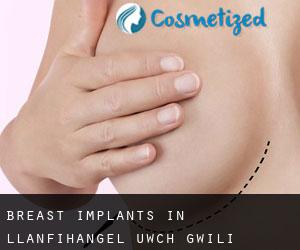 Breast Implants in Llanfihangel-uwch-Gwili