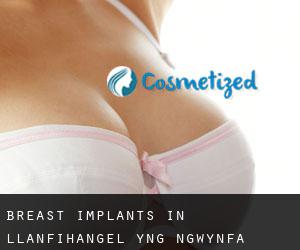 Breast Implants in Llanfihangel-yng-Ngwynfa