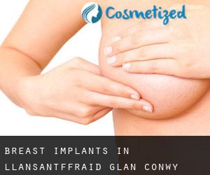 Breast Implants in Llansantffraid Glan Conwy