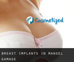 Breast Implants in Mansel Gamage