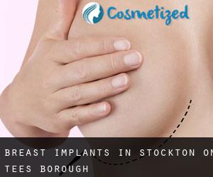 Breast Implants in Stockton-on-Tees (Borough)