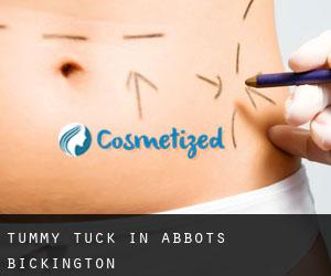 Tummy Tuck in Abbots Bickington