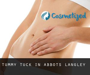 Tummy Tuck in Abbots Langley Tummy Tuck in Abbots Langley
