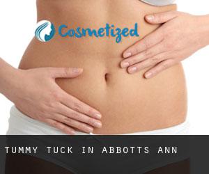 Tummy Tuck in Abbotts Ann