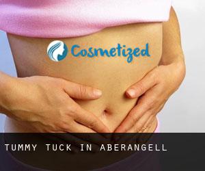 Tummy Tuck in Aberangell