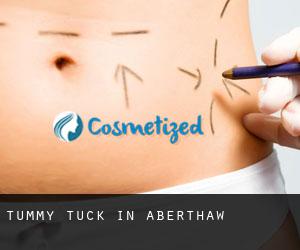 Tummy Tuck in Aberthaw