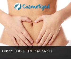 Tummy Tuck in Achagate