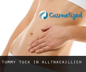 Tummy Tuck in Alltnacaillich