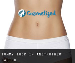 Tummy Tuck in Anstruther Easter