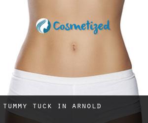 Tummy Tuck in Arnold