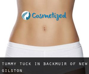 Tummy Tuck in Backmuir of New Gilston