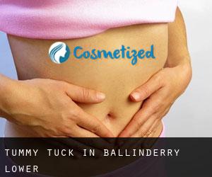 Tummy Tuck in Ballinderry Lower