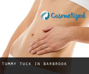 Tummy Tuck in Barbrook