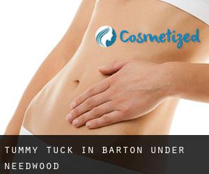 Tummy Tuck in Barton under Needwood