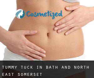 Tummy Tuck in Bath and North East Somerset