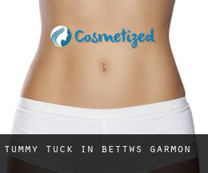 Tummy Tuck in Bettws Garmon