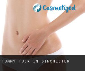 Tummy Tuck in Binchester
