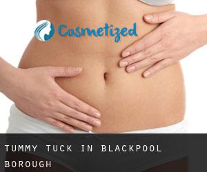 Tummy Tuck in Blackpool (Borough)