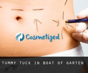Tummy Tuck in Boat of Garten