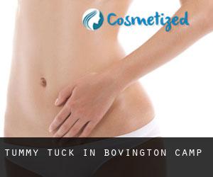 Tummy Tuck in Bovington Camp