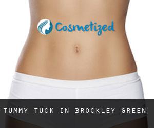Tummy Tuck in Brockley Green