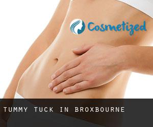 Tummy Tuck in Broxbourne Tummy Tuck in Broxbourne