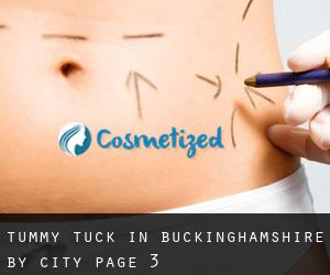 Tummy Tuck in Buckinghamshire by city - page 3